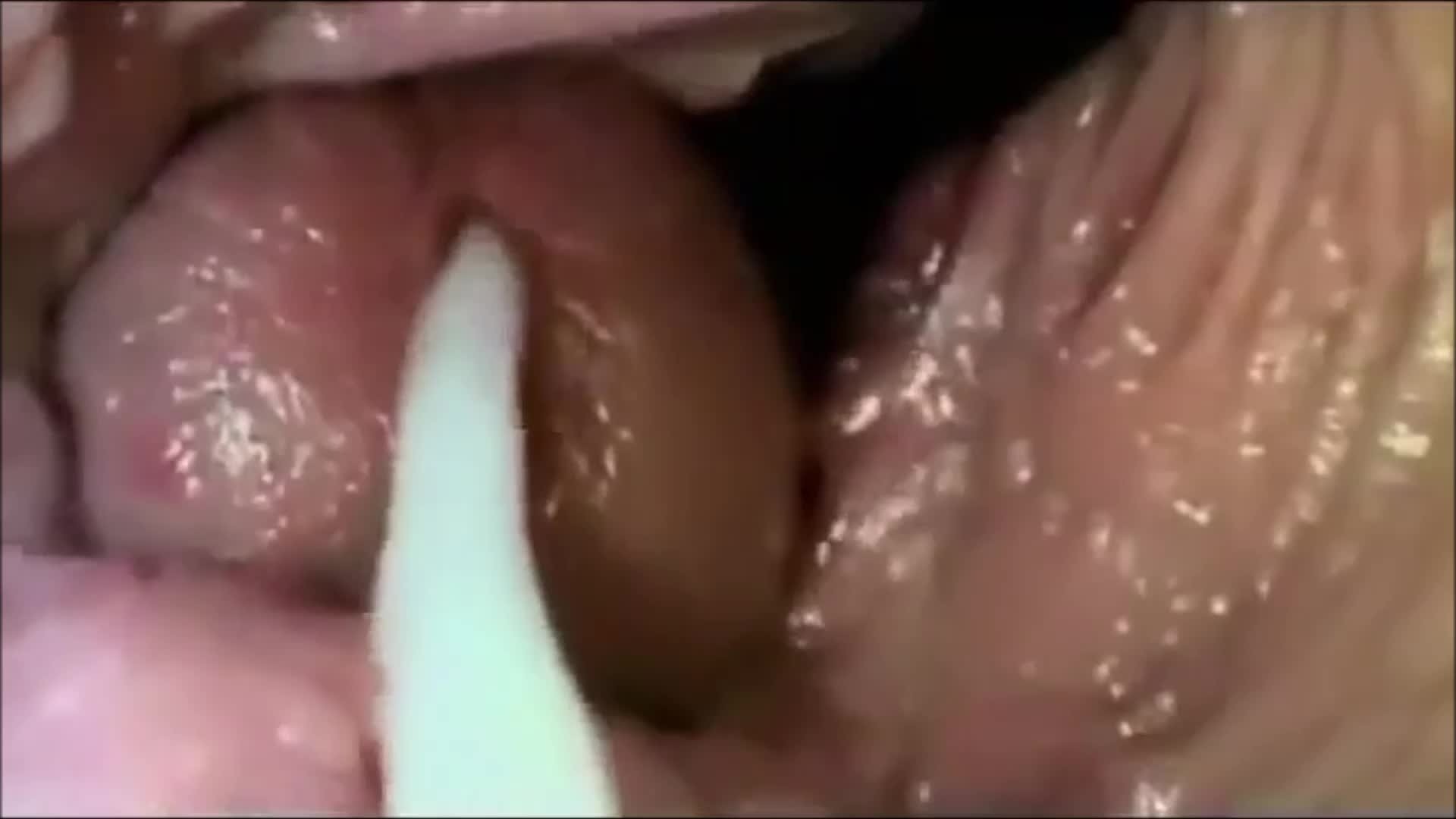 Camera inside of a vagina