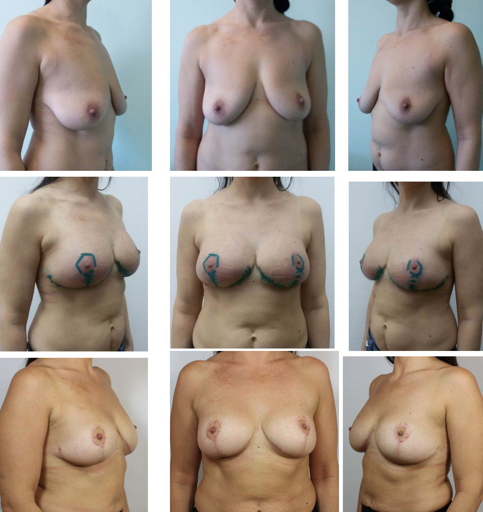 Разные формы женской груди фото порно видео