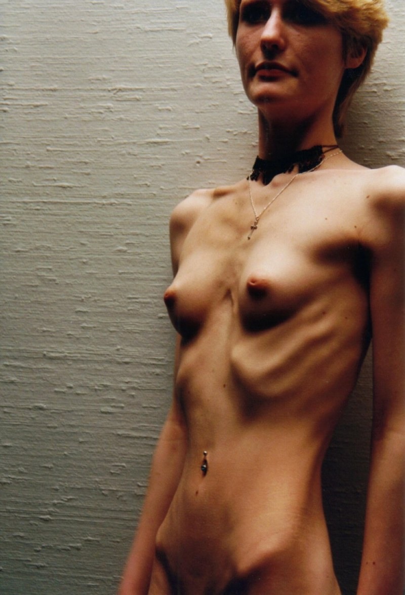 фото голая анорексия