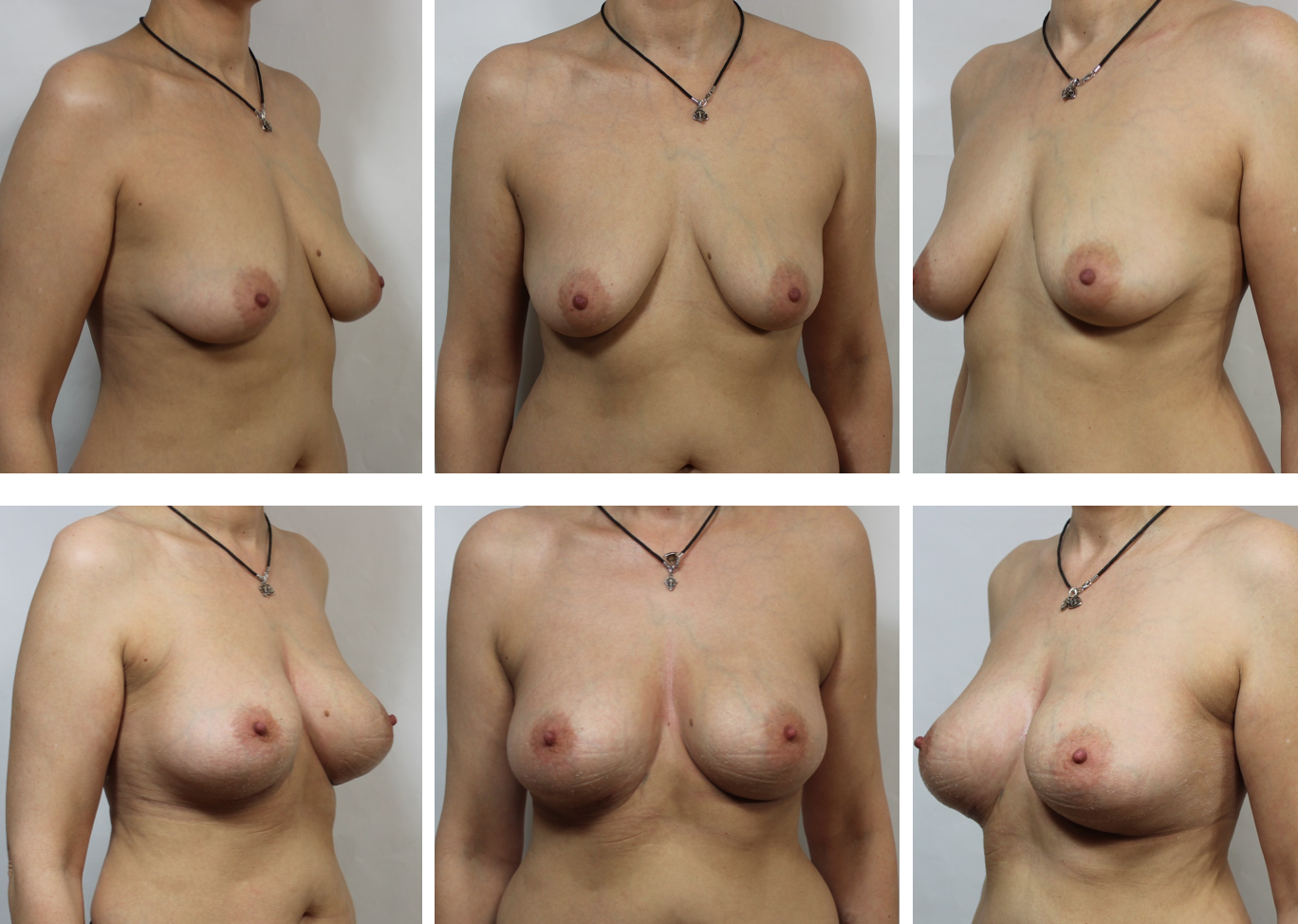 грудь разного размера при сексе фото 11